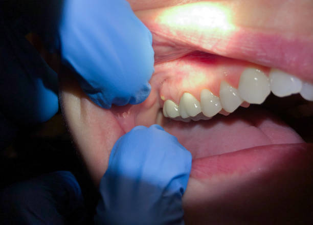Best Urgent Tooth Repair  in Canutillo, TX